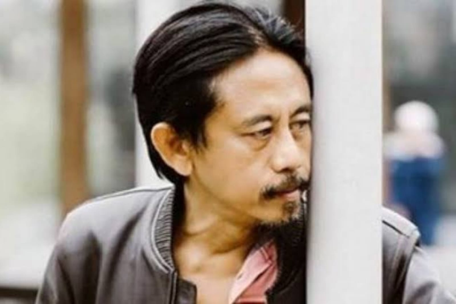 Kisah Inspiratif Epy Kusnandar Lolos dari Kanker Otak, Kini Siap Hadapi Kehidupan